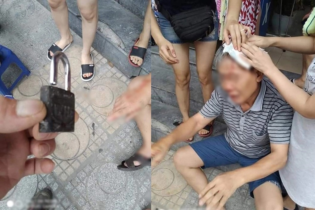 Sống thấp thỏm ở chung cư vì sợ... dao bay, thớt liệng trúng đầu - 3 Sống thấp thỏm ở chung cư vì sợ... dao bay, thớt liệng trúng đầu - 3