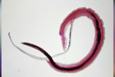 Khách nam bị ký sinh trùng chui vào “chỗ hiểm” và đẻ trứng