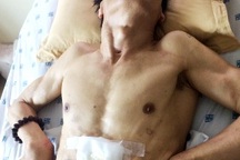 Tòa thụ lý vụ án tai biến, gia đình đòi tăng bồi thường lên 31,5 tỷ!