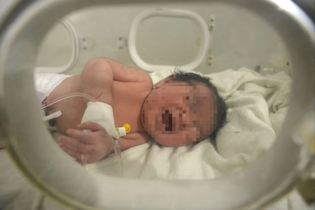 Bé gái Syria được kéo ra từ đống đổ nát, dây rốn vẫn dính mẹ - 1 Bé gái Syria được kéo ra từ đống đổ nát, dây rốn vẫn dính mẹ - 1