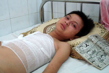 Bỏng nặng vì... dựa cột điện đọc truyện 