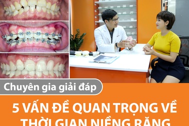 Thời gian niềng răng: 5 vấn đề quan trọng được chuyên gia giải đáp