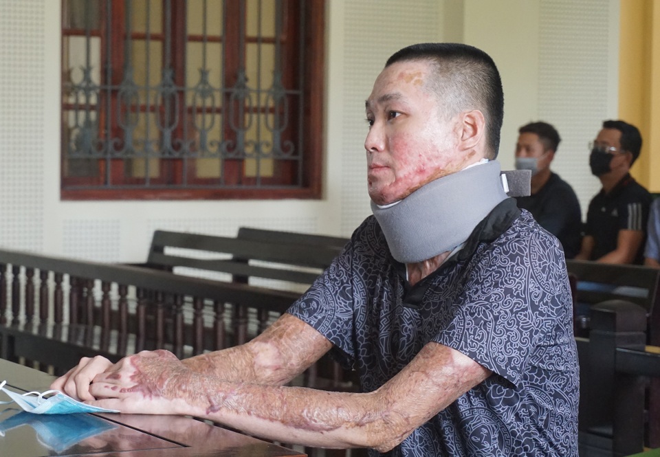 Nam thanh niên tẩm xăng đốt đồng nghiệp vì món nợ 2,5 triệu đồng - 2 Nam thanh niên tẩm xăng đốt đồng nghiệp vì món nợ 2,5 triệu đồng - 2