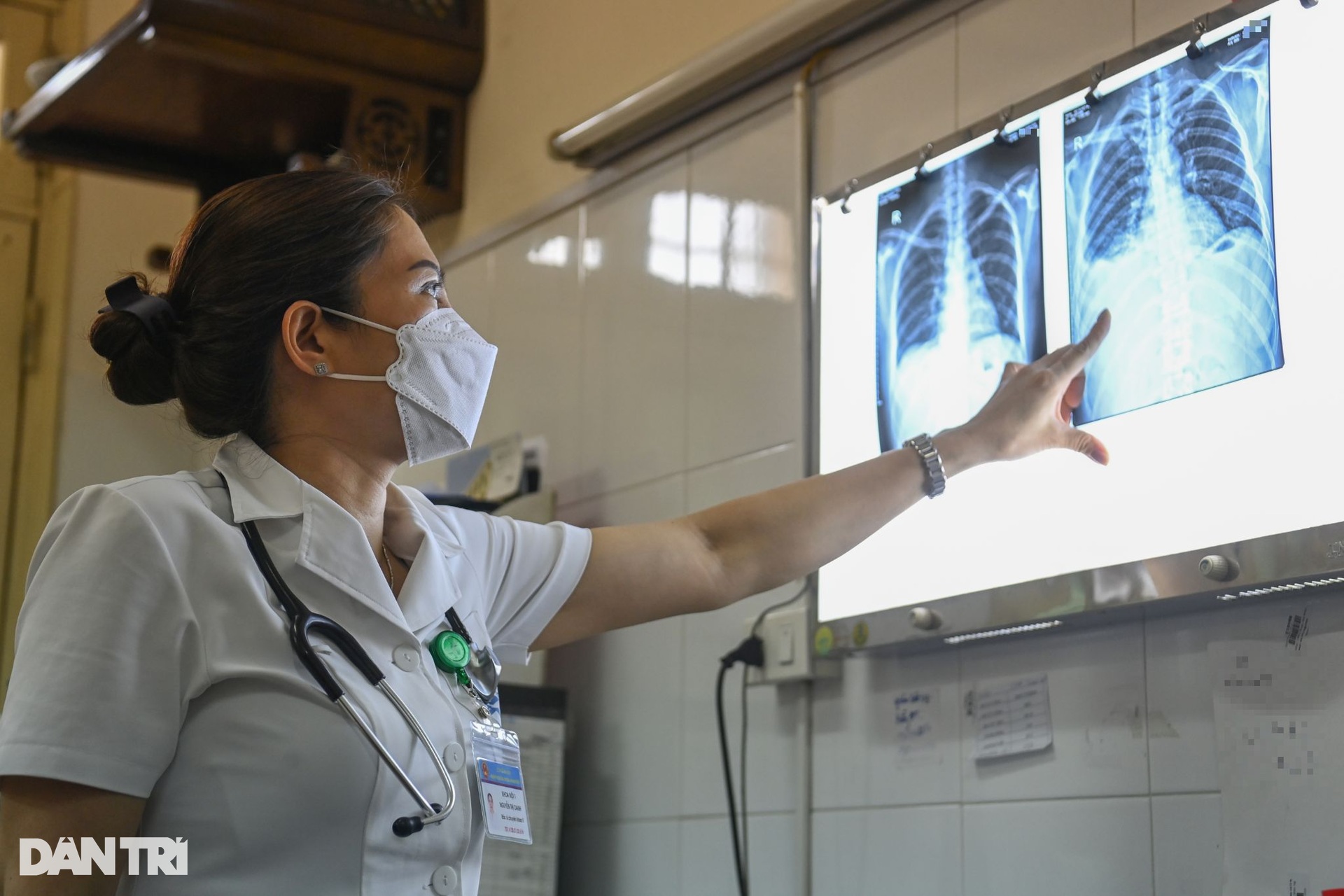 Hà Nội: Bệnh viện kín giường vì sốt xuất huyết, bệnh nhân ám ảnh cô đặc máu - 6 Hà Nội: Bệnh viện kín giường vì sốt xuất huyết, bệnh nhân ám ảnh cô đặc máu - 6