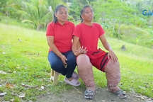 Chuyện tình cảm động của chàng trai Philippines mắc bệnh chân voi