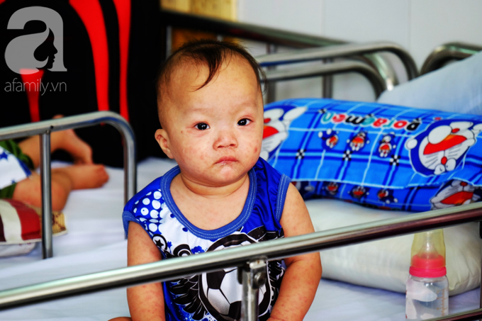 Bộ trưởng Y tế trực tiếp thị sát dịch sởi tại TP.HCM, cảnh báo các bà mẹ không chích ngừa sẽ lãnh hậu quả - Ảnh 8. Bộ trưởng Y tế trực tiếp thị sát dịch sởi tại TP.HCM, cảnh báo các bà mẹ không chích ngừa sẽ lãnh hậu quả - Ảnh 8.