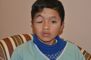 Cậu bé “ngụp lặn dưới dòng nước buốt” được phẫu thuật mắt