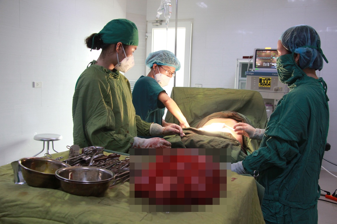 Đến viện với bụng như bầu 9 tháng, người phụ nữ được bóc khối u khổng lồ - 2 Đến viện với bụng như bầu 9 tháng, người phụ nữ được bóc khối u khổng lồ - 2