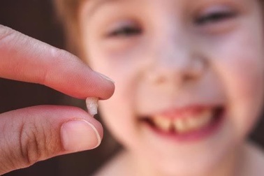 Răng sữa hư, nhổ bỏ sẽ gây hại răng vĩnh viễn?