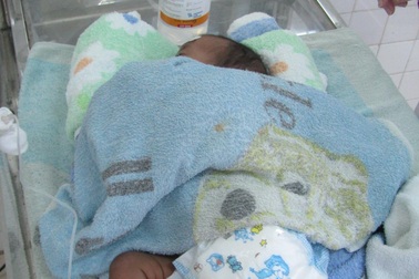 Bé 9 ngày tuổi bị bỏng nặng mất chân trái