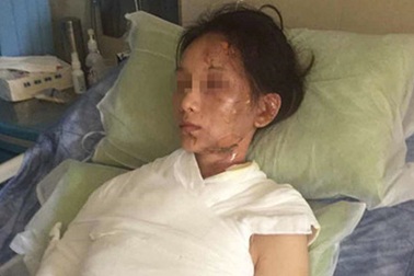 Đổ nước lẩu lên người thực khách, nhà hàng phải bồi thường gần 800 triệu