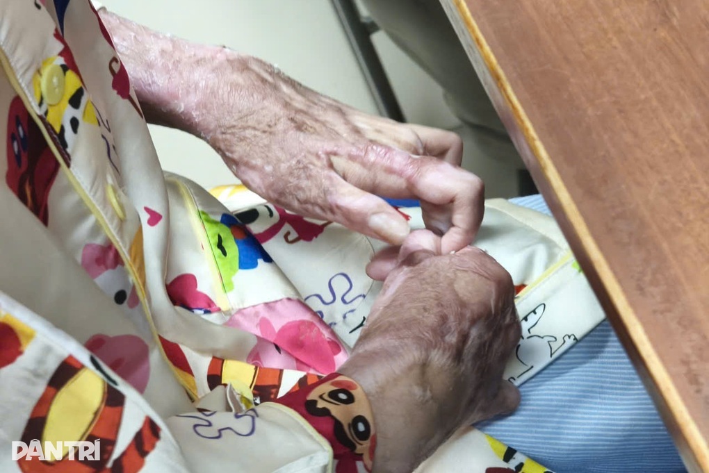 Thiếu nữ 17 tuổi bị bạn đốt keo nến làm cháy khắp người, phải mổ 15 lần - 2 Thiếu nữ 17 tuổi bị bạn đốt keo nến làm cháy khắp người, phải mổ 15 lần - 2