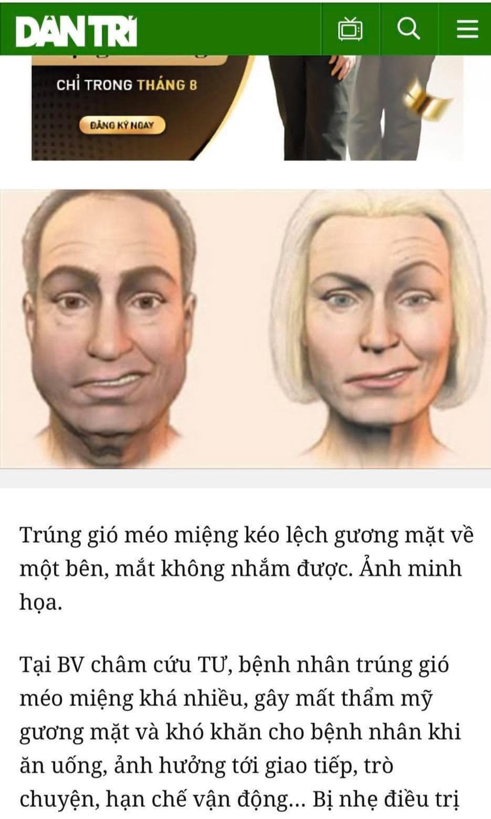 Lời cảnh tỉnh của chàng Youtuber sau hành trình chữa trúng gió méo miệng - 2 Lời cảnh tỉnh của chàng Youtuber sau hành trình chữa trúng gió méo miệng - 2