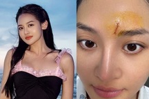 Thùy Anh bị NSX đòi bồi thường 20 tỷ đồng: "Tôi đau đớn thể xác, tinh thần"