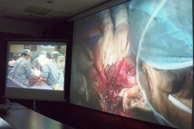 Cắt khối bướu 90kg khỏi cơ thể bệnh nhân Duy Hải