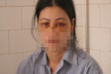 Khốn khổ người vợ bị chồng đánh đập, dọa ép ăn phân lợn