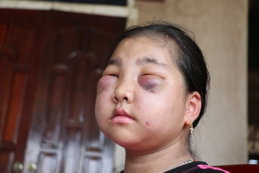 Cuốn bệnh án đẫm nước mắt của người mẹ nghèo có con gái mắc bệnh lạ