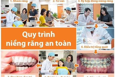 Niềng răng 1 hàm là gì? Có nên niềng răng 1 hàm không?