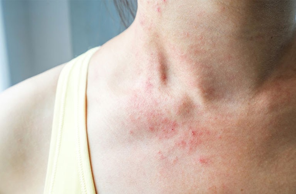 Soi gương mỗi ngày để sớm phát hiện bệnh ung thư gan - 4 Soi gương mỗi ngày để sớm phát hiện bệnh ung thư gan - 4