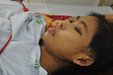 Mắc chứng bệnh Lupus, tính mạng người mẹ trẻ nguy kịch