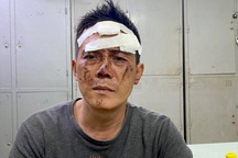 Gã nghiện dùng kim tiêm uy hiếp cô gái để cướp tài sản