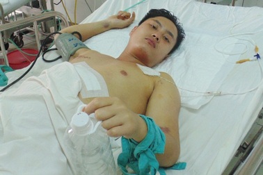 Cứu sống bệnh nhân bị vỡ gan vì tông vào cột điện