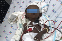 Căn bệnh khiến bé gái bị "nam hóa", cha mẹ da trắng sinh con da đen sậm