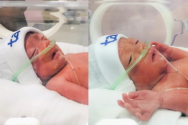 Nghẹt thở ca mổ  bắt con “độc nhất vô nhị” trong ngành sản khoa