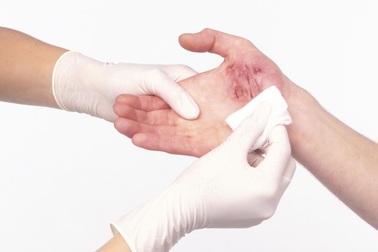 3 cách tự chữa bệnh cần quên ngay lập tức