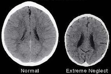 Sự quan tâm chăm sóc - Dinh dưỡng tốt nhất cho não trẻ