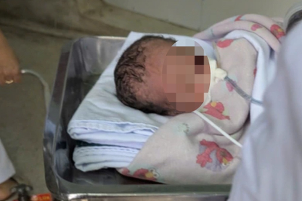 Cứu hai trẻ sinh rớt, vừa chào đời đã ngưng tim, ngưng thở - 1 Cứu hai trẻ sinh rớt, vừa chào đời đã ngưng tim, ngưng thở - 1