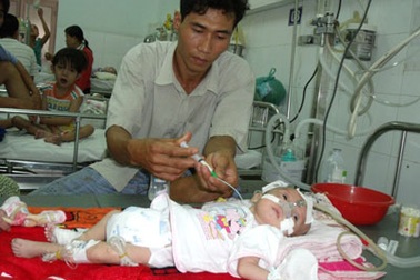 Cháu bé 2 tháng tuổi thoi thóp trên tay cha mẹ nghèo