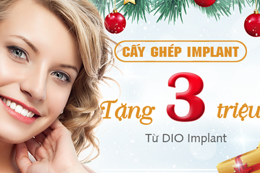 Cấy ghép implant 3D: phương pháp phục hình răng vĩnh viễn
