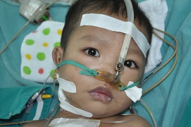 Mắc dị tật tim bẩm sinh phức tạp, tính mạng bé 2 tuổi thoi thóp từng ngày