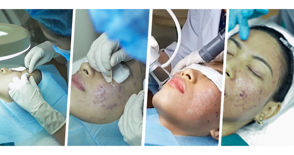 Doctor Scar - Tiên phong áp dụng công nghệ bóc tách sẹo tại việt nam - 3 Doctor Scar - Tiên phong áp dụng công nghệ bóc tách sẹo tại việt nam - 3