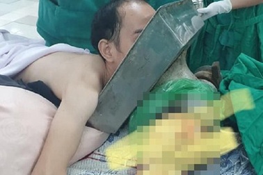 Người đàn ông bị máy xay thịt “nuốt chửng” cánh tay