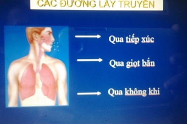 Tập huấn cho hơn 100 cán bộ, nhân viên y tế về vi rút MERS