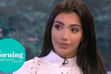 Chloe Khan chia sẻ về việc phẫu thuật thẩm mỹ