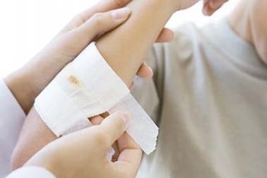 Vết thương có mau lành khi rắc bột kháng sinh không?