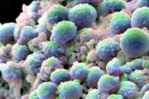 Chất béo trong dầu cọ "tiếp sức" cho ung thư di căn?