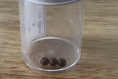 Ngậm bi nam châm xem tivi, bé trai 6 tuổi hoại tử dạ dày