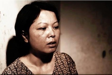 Cuộc sống tính từng ngày của cô giáo bị ung thư phổi do khói thuốc