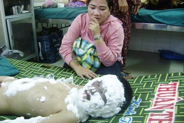 Nổ tủ điện, một bé phỏng nặng
