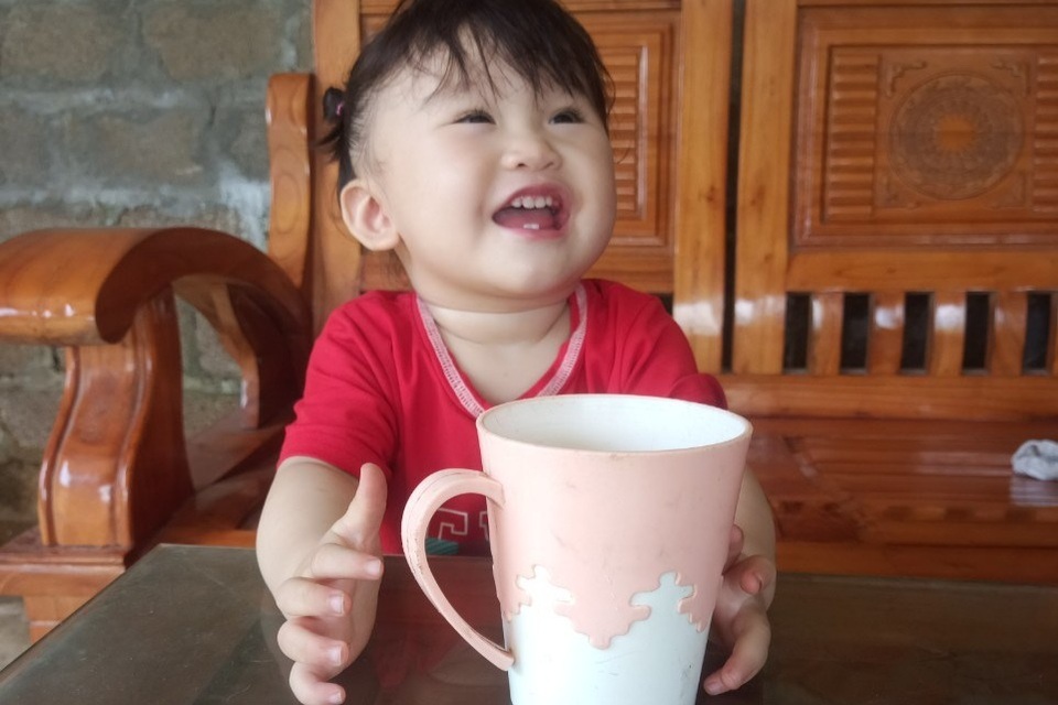 Bé gái 14 tháng tuổi ngã vào nồi nước sôi được bạn đọc giúp đỡ đã xuất viện - 3 Bé gái 14 tháng tuổi ngã vào nồi nước sôi được bạn đọc giúp đỡ đã xuất viện - 3