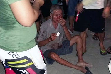 Hà Nội: Nam thanh niên đánh cụ già nhập viện sau va chạm giao thông