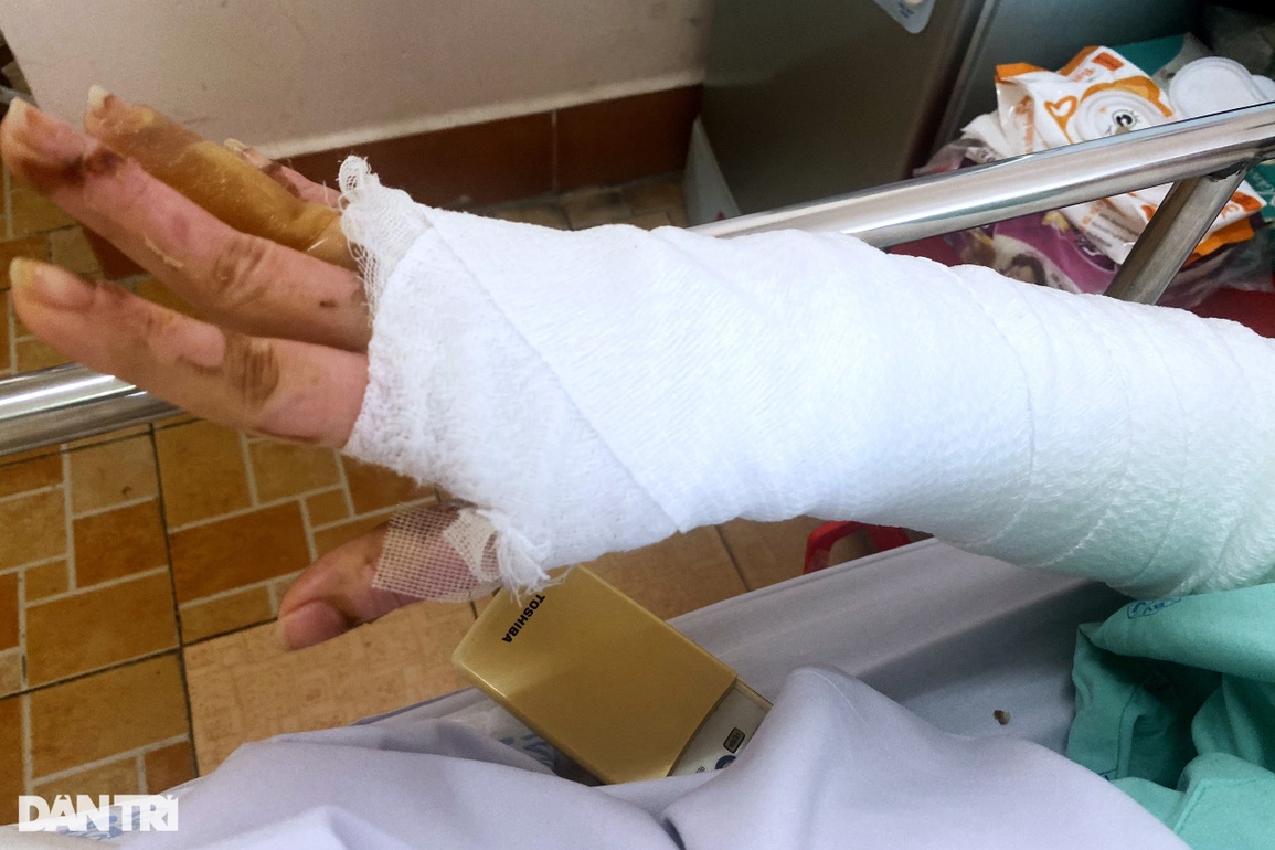 Vợ gần sinh và con trai bỏng nặng vì chồng đá trúng chai cồn vào người - 2 Vợ gần sinh và con trai bỏng nặng vì chồng đá trúng chai cồn vào người - 2