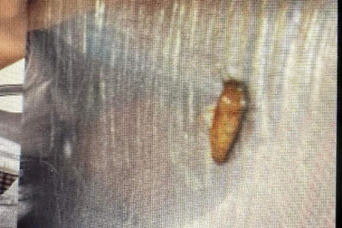 Vụ côn trùng trong bữa sáng trường tư: Đuổi việc nhân viên trực khu đồ ăn