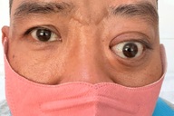 TPHCM: Bệnh nhân từ chối phẫu thuật, đòi về vì “lồi mắt sao lại mổ xoang”