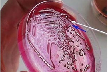 Siêu khuẩn kháng thuốc thực chất không đáng sợ!