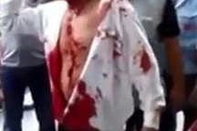 Hành khách bị đánh bê bết máu vì “ý kiến” với nhà xe